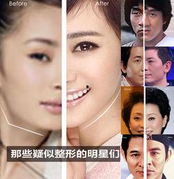 爆料明星整容视频大全集,视频大全集深度解析